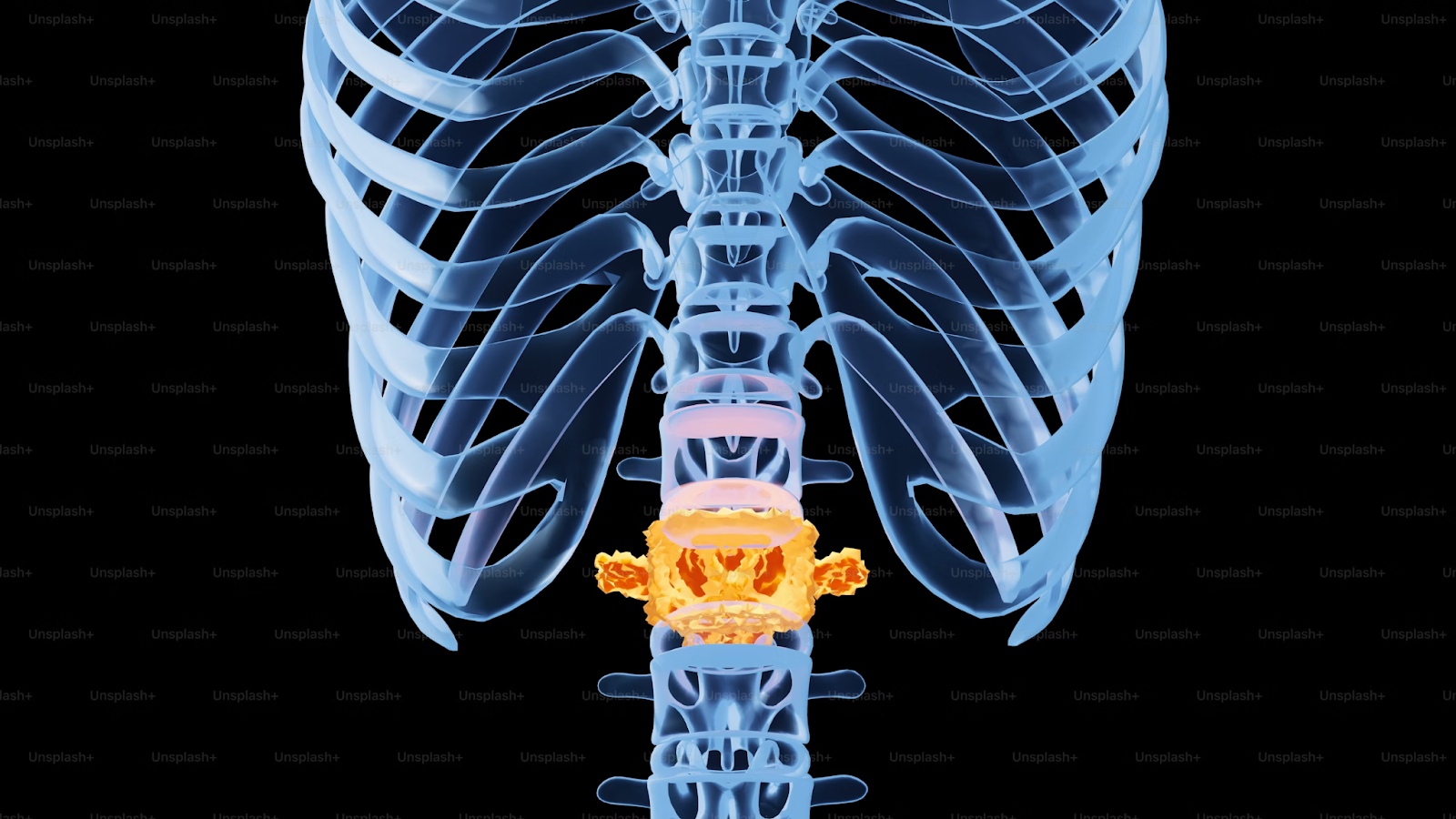 Adjusting To Life With a Spinal Cord Stimulator